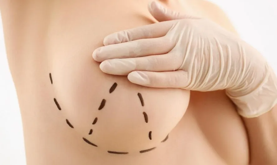 Jak wygląda zabieg zmniejszenia piersi?